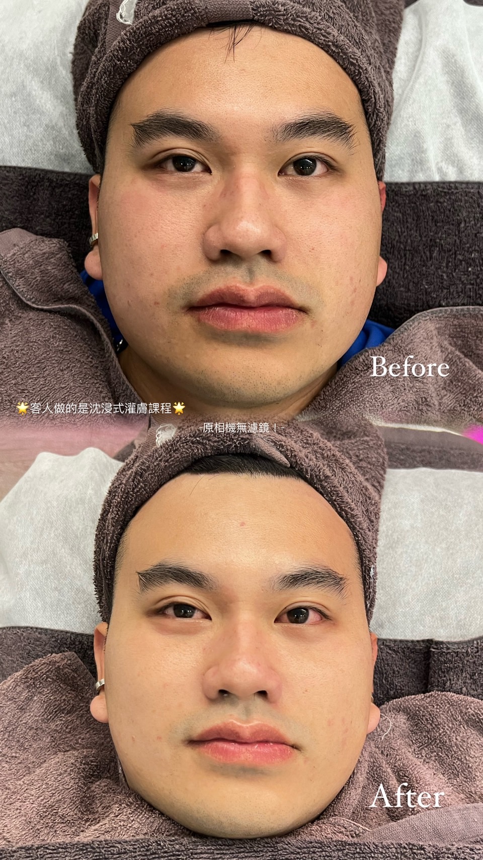 做臉案例
